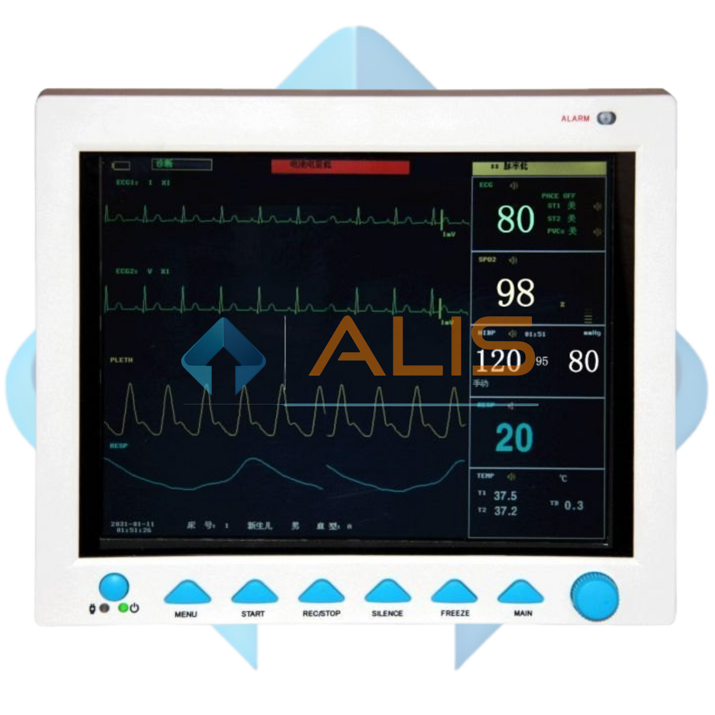 5 Para Bed Side Monitor from Contec